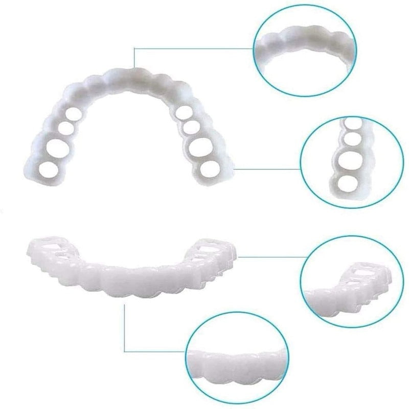 Carillas snap on smile dientes