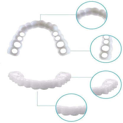 Carillas snap on smile dientes