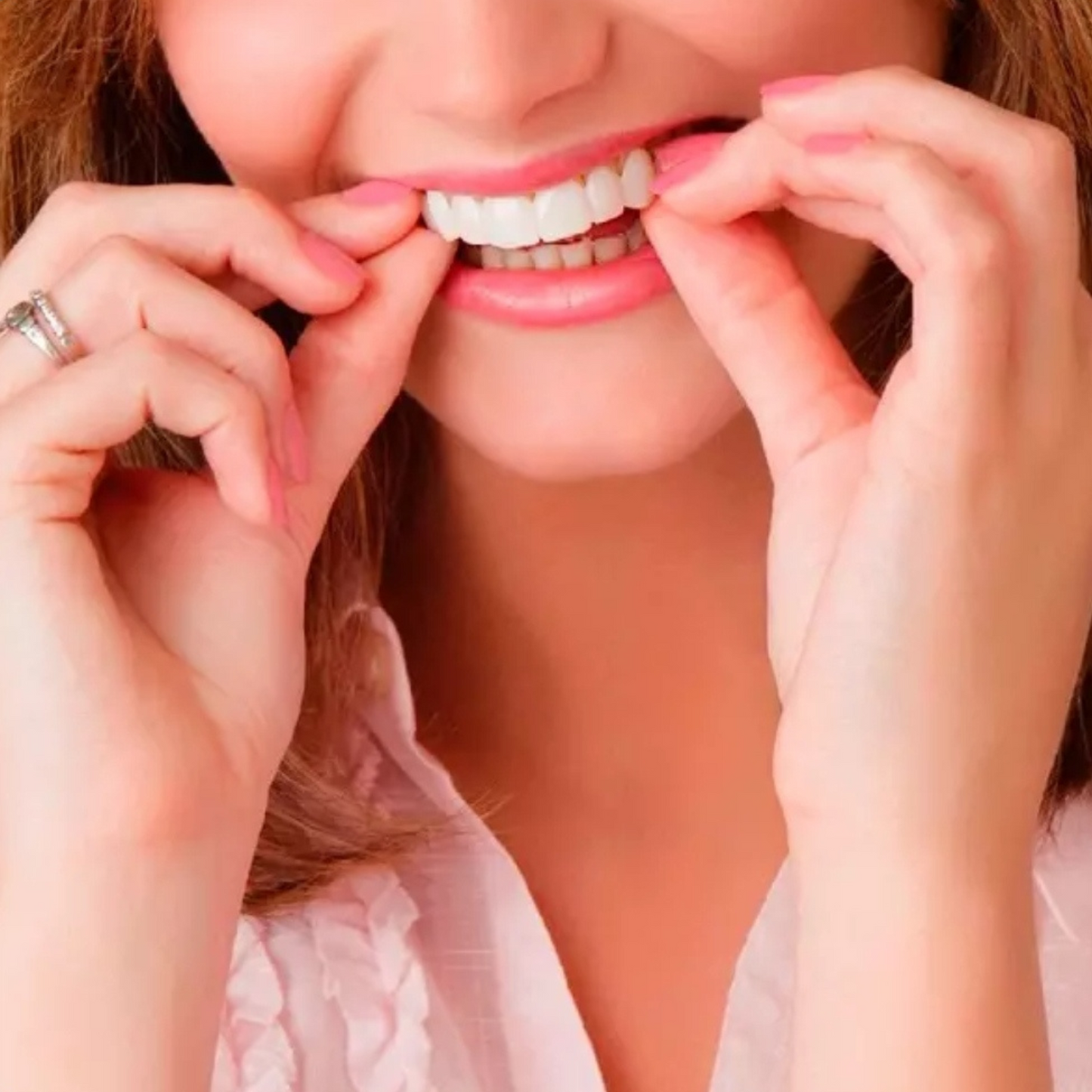 Carillas Postiza Dentadura SnapOn Smile