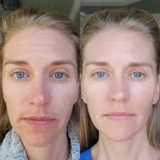 Parches de Colágeno Autodisolvente SkinLab+