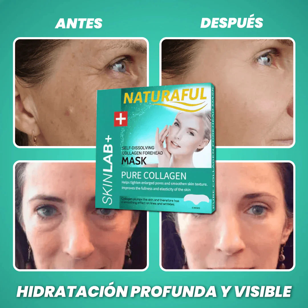 Parches de Colágeno Autodisolvente SkinLab+